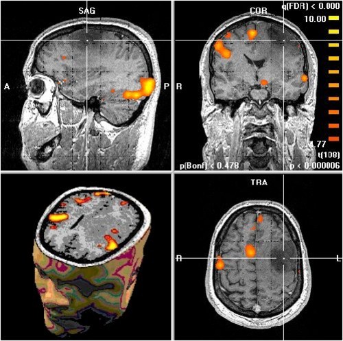 Las imágenes obtenidas con resonancia magnética permite a los científicos observar lo que ocurre en el cerebro durante el ejercicio(foto con fines ilustrativos tomada de http://neuromarca.com/neuromarketing/fmri/)