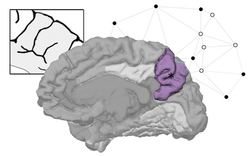 El precúneo es clave en la diversidad de la anatomía del cerebro humano/Bruner et al.