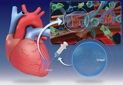 El hidrogel inyectable tiene capacidad para regenerar el tejido cardiaco dañado tras un infarto de miocardio/BIOFORGE