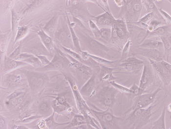 Muestra de células madre obtenidas en la investigación vistas al microscopio