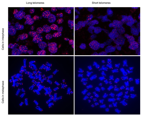 Células humanas con telómeros largos (izquierda) y con telómeros cortos (derecha)./CNIO.