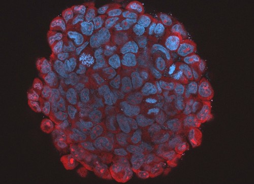 Esferoide tumoral con células madre de meduloblastoma/ imagen: Laboratorio de Genómica Traslacional del IB-USP.