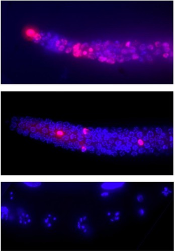 Células del gusano C. elegans. El ADN aparece destacado en azul y la marca de condensación cromosómica, en rojo./ T. García-Muse