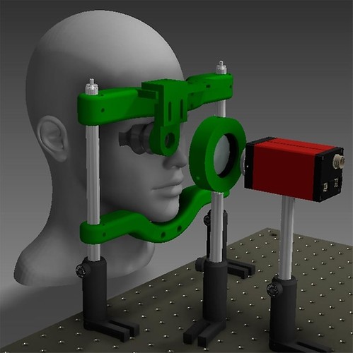 RetiDiag es un dispositivo que permite a los usuarios de forma autónoma tomar una fotografía de sus ojos, para el diagnóstico de la retinopatía diabética, una de las principales causas de la ceguera.