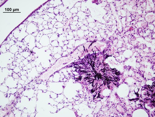 El hongo Aspergillus en pulmón de ratón. Foto: José Antonio Calera.