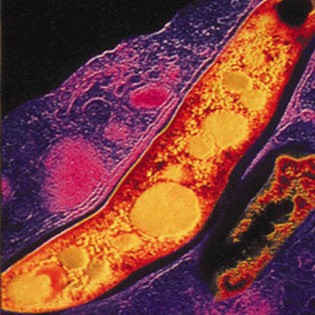 Mycobacteria responsable de la tuberculosis