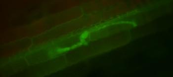 Células de maíz invadidas por el hongo causante de la antracnosis, 'Colletotrichum graminicola'. Las células de la planta tienen formas rectangulares y el hongo aparece en verde fluorescente. Foto: Michael Thon.