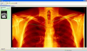 Imagen médica procesada por la plataforma Ginkgo (FOTO: Metaemotion).