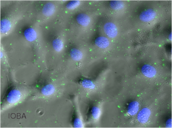  Imagen de microscopía de fluorescencia. Las nanopartículas marcadas en verde se observan en el interior de células de epitelio corneal, incluso en el núcleo celular, marcado en azul.