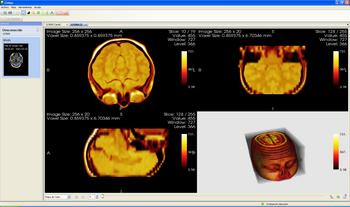 Metaemotion trata de facilitar el diagnóstico conla ayuda de imágenes (Foto cedida por los investigadores).