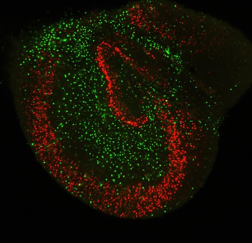 Imagen de fluorescencia de una rodaja cultivada de hipocampo de rata donde se muestran los somas de las neuronas (en rojo) y de los astrocitos (en verde)./CSIC.
