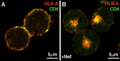 El panel A muestra la distribución normal de CD4 (en verde) y MHC-I (HLA, en rojo) en linfocitos T. El panel B muestra el cambio en la distribución de esas dos proteínas en un linfocito T/Estela A. Pereira y Luis L. P. da Silva/FMRP-USP