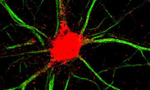 Tinción para eEF1A2 (rojo) en neuronas del hipocampo de ratones. / IBMB-CSIC.