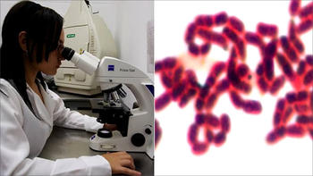 El biopolímero es caracterizado con un microscopio. A la derecha, la imagen microscópica de la bacteria Ralstonia euthopha, acumulando el biopolímero PHA en su estructura celular (FOTO: UDEA).