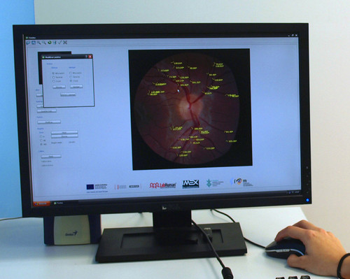 Monitor que muestra los resultados de las pruebas oculares.