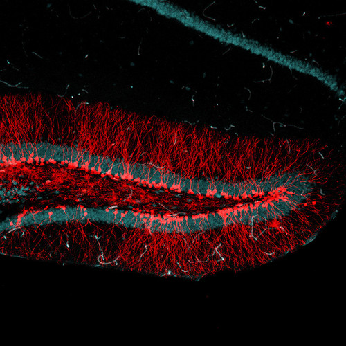 Foto de neuronas nuevas. Se van integrando al circuito cerebral a medida que fijan en la memoria experiencias novedosas.  Créditos: Diego Álvarez