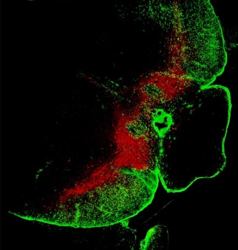 La presencia de neuronas positivas para la enzima Tirosina hidroxilasa (en rojo) y las células de la microglía (en verde) (imagen: revista Glia).