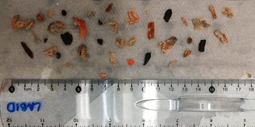 Residuos de microplásticos removidos de las especies de peces/M. Astorga.
