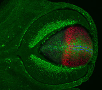 Imagen compuesta de un ojo de embrión de ratón y el disco imaginal de un ala de Drosophila en la que se han evidenciado por inmunotinción las células ganglionares. / Foto: CSIC