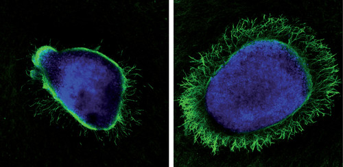 Neuronas expuestas a neutrofinas (izq.) o a la unión de la proteína del virus del herpes simple tipo 2 y neutrofinas. Imagen: CSIC.