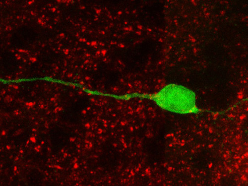 Neurona.// Carlos Vicario et al.