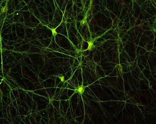 Neuronas de hipocampo, el lugar donde se almacenan los recuerdos. Imagen: UCAN.