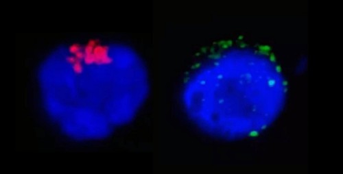 En la imagen de la izquierda es posible observar a la enzima RdRp del SARS-CoV-2 (en rojo). en la imagen de la derecha, las manchas verdes corresponden a las proteínas de la espícula del SARS-CoV-2 (spike proteins)/Henrique Marques-Souza/Unicamp