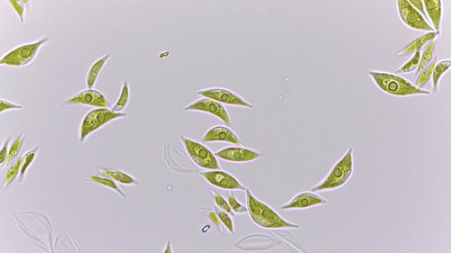 Algas en una foto de microscopía óptica. Imagen: Gentileza investigadores.