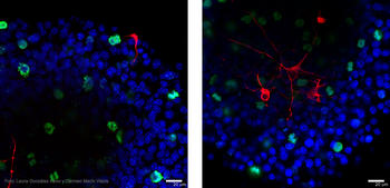Comparación de neuroesferas entre ratones control (izquierda) y modificados, los KO, de 'p73'.  En un medio de proliferación, se empieza a observar la aparición de neuronas (rojo) en los KO.