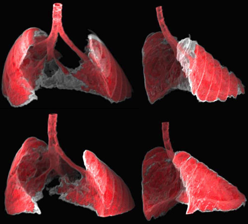 Imágenes obtenidas por TAC de los pulmones de un ratón con fibrosis./Guillermo Garaulet y Francisca Mulero, CNIO.