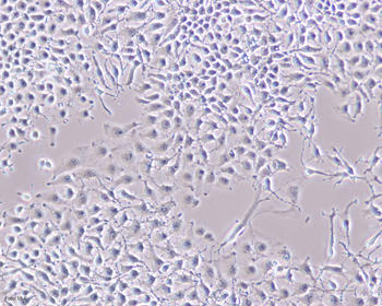 Imagen al microscopio de un cultivo de células tumorales hepáticas sin tratar, donde se observa la proliferación celular.