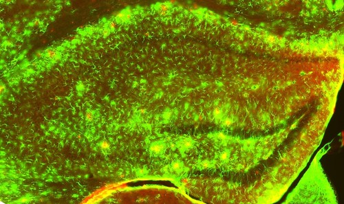 En verde, el GFAP y, por tanto, los astrocitos reactivos en zonas de patología, donde hay placas amiloides (en rojo). Imagen: UB.