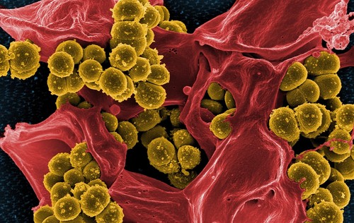 Linfocitos neutralizando una infección bacteriana. / Pixabay.