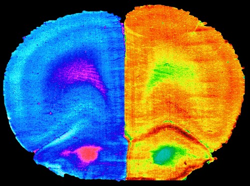 Diferencias en la actividad cerebral de un ratón./IPLA-CSIC-UV.