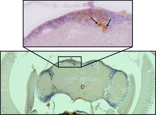 En la parte inferior se muestra un cerebro de mosca completo; en la parte superior, una ampliación de la zona en recuadro que muestra depósitos de proteína amilode beta (indicados con las flechas). FOTO: AGENCIA CYTA.