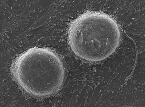 Microscopia electrónica de barrido de los cultivos 3D de las células de la papila dérmica encargadas de activar las células madre que dan origen al pelo/Agencia CYTA-Instituto Leloir