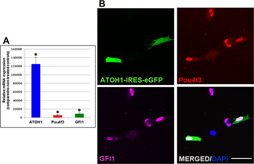 Sobre-expresión de los tres genes (ATOH1, GFI1 y Pou4f3) en fibroblastos humanos/Durán et al. 2018