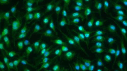Marcadores inflamatorios (en verde) en el núcleo de los macrófagos (en azul)./IRB Barcelona.