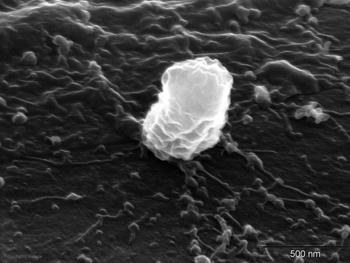 Imagen de microscopio en la que se observa a la bacteria 'Rhizobium' colonizando la raíz del trébol.