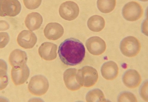 Imagen de un linfocito rodeado de glóbulos rojos: Wikipedia