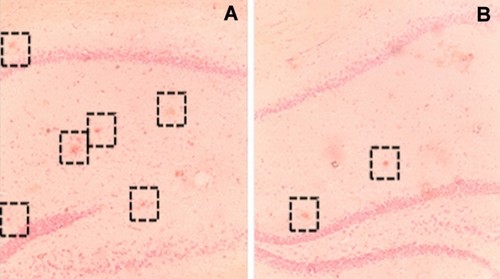Concentración de placas seniles en el cerebro de ratones transgénicos que no recibieron estímulos cognitivos (A) y en el de animales expuestos a un ambiente enriquecido (B)/Frontiers in Aging Neuroscience