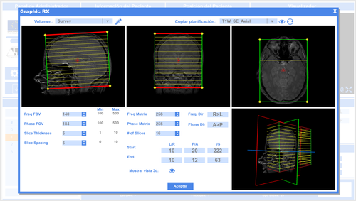 Captura del panel del simulador de resonancia magnética donde se realiza la localización espacial de los cortes/Daniel Treceño