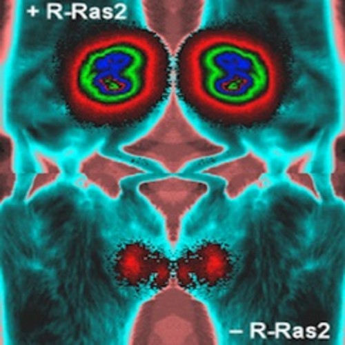 Tamaño del tumor en ratones con TC21 y sin TC21. Imagen: CIC.