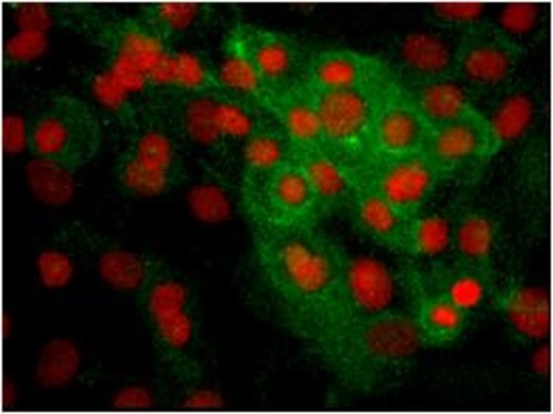 Cultivo primario de epitelio limbar. Se ve en rojo los núcleos celulares y en verde la expresión de la proteína ABCG2, que nos indica la presencia de células con un fenotipo propio de células madre epiteliales limbares. FOTO: Marina López.