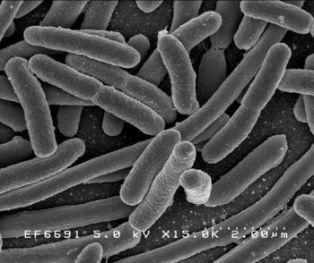 Bacterias 'Escherichia coli', el agente causante más frecuente de la sepsis puerperal. vistas al microscopio.