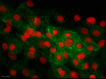Cultivo primario de limbo realizada con un microscopio invertido de fluorescencia a 40X aumentos. En rojo se muestran los núcleos celulares y en verde proteínas celulares que se expresan de forma mayoritaria en las células madre del epitelio del limbo.