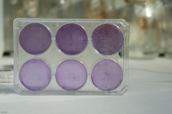 Cultivo celular. Las zonas no teñidas corresponden a células infectadas con el poxvirus vaccinia que expresa proteínas del virus del SIDA. Foto: CSIC.