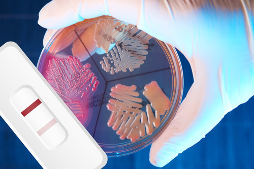Nuevo método para detectar Escherichia coli-O157 en productos cárnicos.