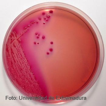 Tí­pico crecimiento de los 'Escherichia coli' verotoxigénicos en un medio de cultivo selectivo