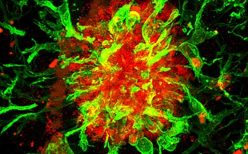 La proteína SFRP1 (rojo), implicada en el alzhéimer, rodeada de células gliales (verde). / Foto: Pilar Esteve.